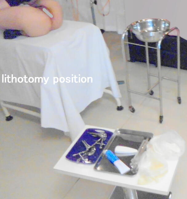 lithotomy position
