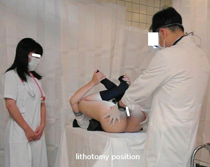 lithotomy position　説明